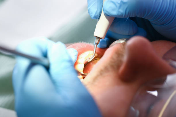 Best Emergency Denture Repair in Naples Park, FL